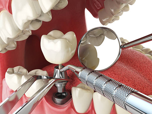Best Cracked Tooth Emergency Dentist  in Elburn, IL